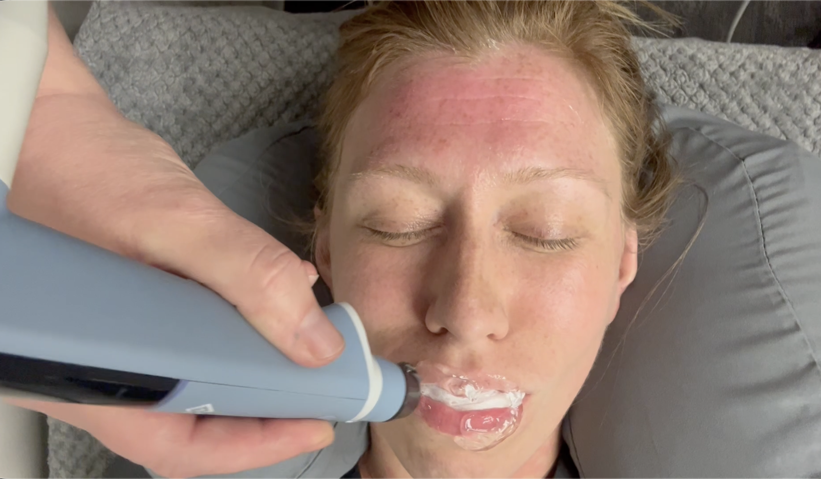 EXION Face & Body at RiverCrest Health